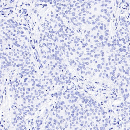 MDR3 Recombinant Rabbit mAb (SDT-1949-60)