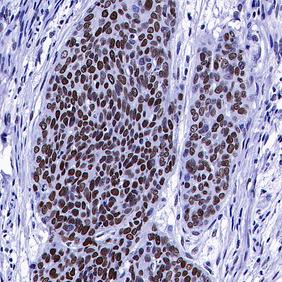Histone H3 Recombinant Rabbit mAb (S-5672)
