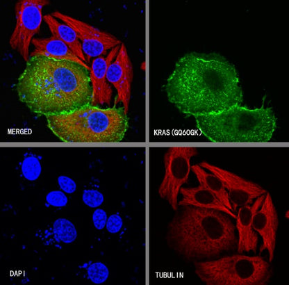 KRAS (mutated GQ60GK) + (mutated Q61K) Recombinant Rabbit mAb (S-604-4)