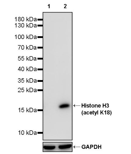 Histone H3 (acetyl K18) Recombinant Rabbit mAb (S-1688-90)