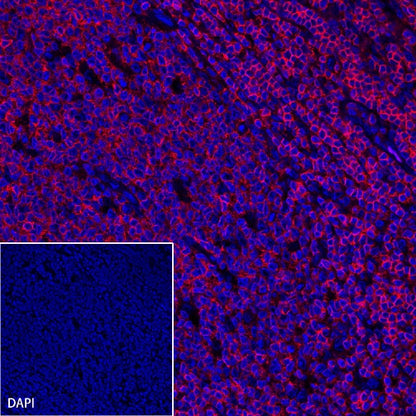 CD45 Recombinant Rabbit mAb (Alexa Fluor® 594 Conjugate) (S-R035)