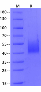 Biotinylated Fc epsilon RI alpha His&Avi Tag Protein, Human