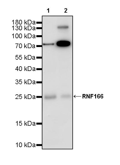 RNF166 Recombinant Rabbit mAb (S-3509-12)