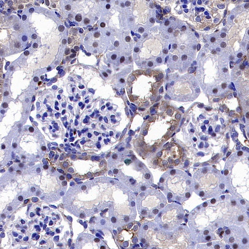 TFEB Recombinant Rabbit mAb,PBS Only (SDT-2411-7)