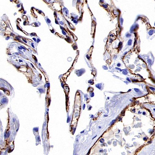 Claudin 5 Recombinant Rabbit mAb (SDT-R322)