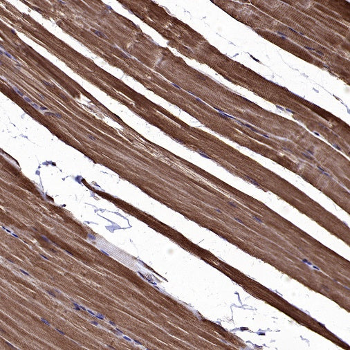 TRIM63 Recombinant Rabbit mAb (S-2304-110)