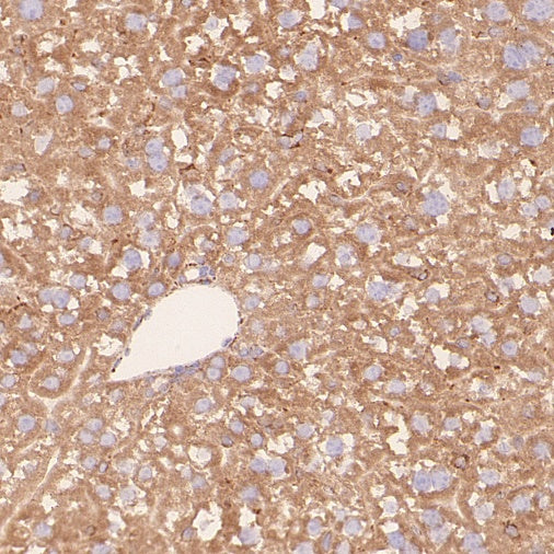 ERAP1 Recombinant Rabbit mAb (S-2509-38)