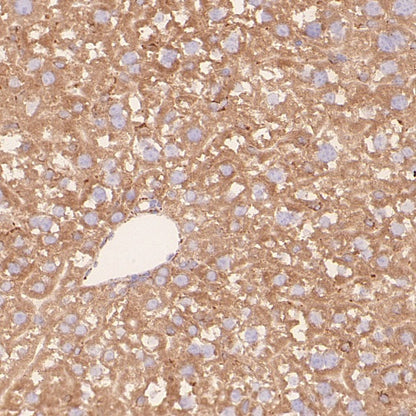 ERAP1 Recombinant Rabbit mAb (S-2509-38)