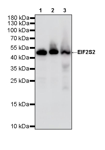 EIF2S2 Rabbit Polyclonal Antibody