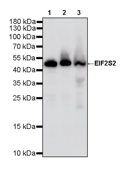 EIF2S2 Rabbit Polyclonal Antibody