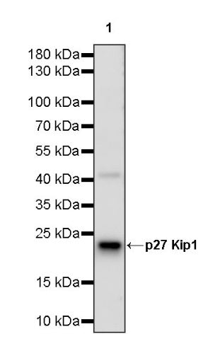 p27 Kip1 Recombinant Rabbit mAb (SDT-361-310)