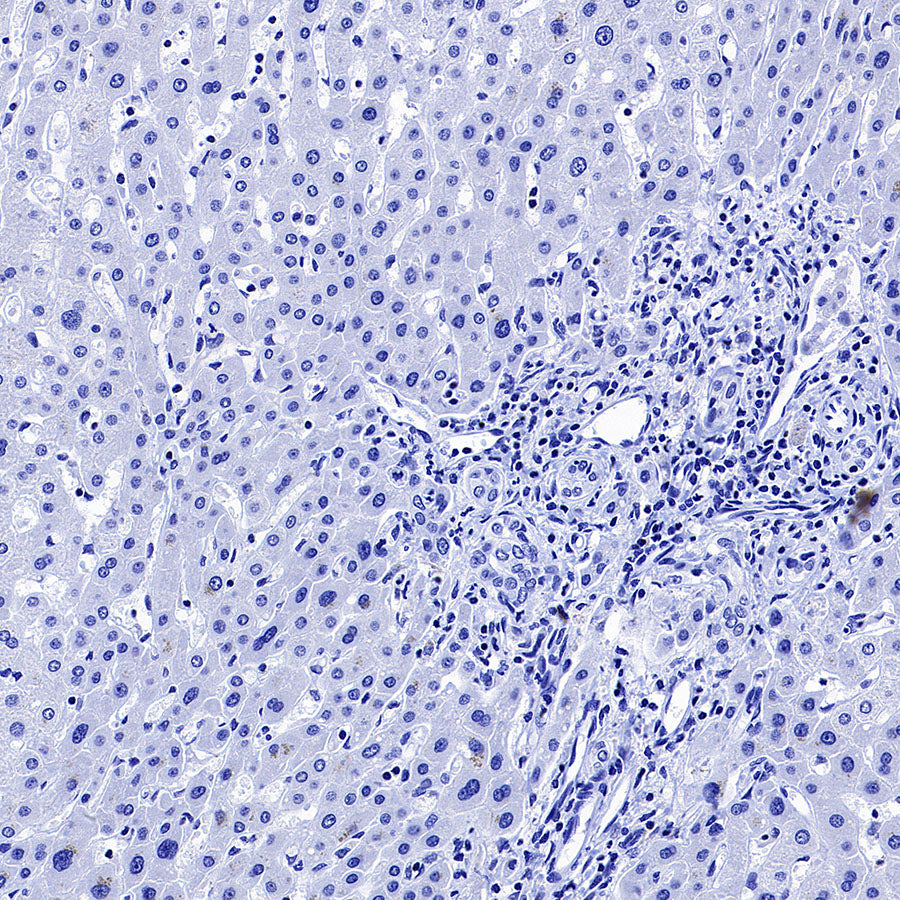 Glypican-3 Recombinant Rabbit mAb (SDT-4064-69)