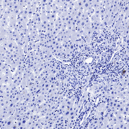 Glypican-3 Recombinant Rabbit mAb (SDT-4064-69)