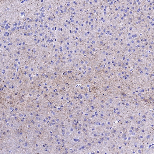 Choline Acetyltransferase/ChAT Recombinant Rabbit mAb (S-2561-17)