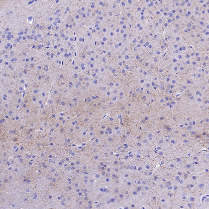 Choline Acetyltransferase/ChAT Recombinant Rabbit mAb (S-2561-17)