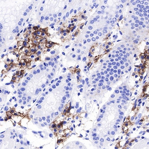 CD19 Recombinant Rabbit mAb (SDT-164-41)