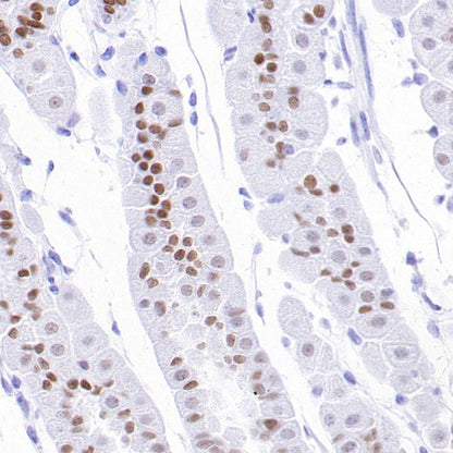 FOXA1 Recombinant Rabbit mAb (SDT-2779-17)