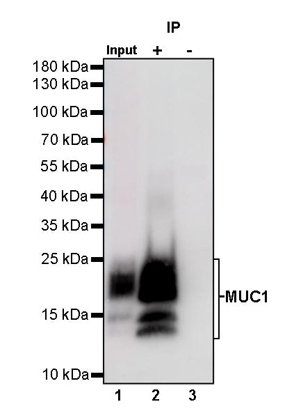 S-RMab® MUC1/EMA Recombinant Rabbit mAb (SDT-776-49)