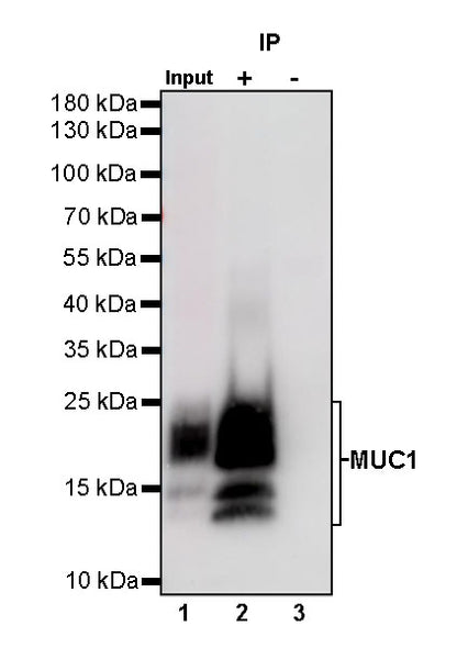 S-RMab® MUC1/EMA Recombinant Rabbit mAb (SDT-776-49)