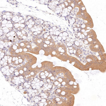 AMPKα Recombinant Rabbit mAb (S-784-68)