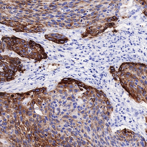 MUC4 Recombinant Rabbit mAb (SDT-841-13)