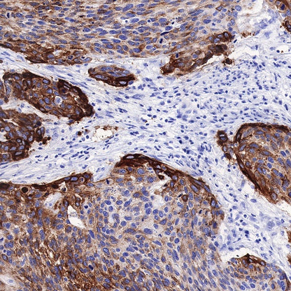 MUC4 Recombinant Rabbit mAb (SDT-841-13)