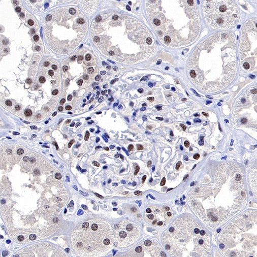 METTL3 Recombinant Rabbit mAb (S-315-219)