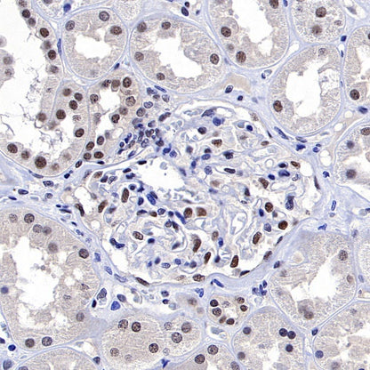 METTL3 Recombinant Rabbit mAb (S-315-219)