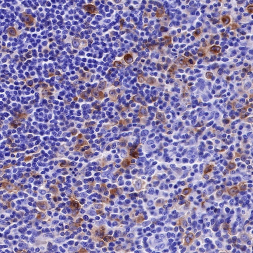 CD25/IL-2Rα Recombinant Rabbit mAb (S-R223)