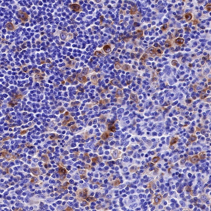 CD25/IL-2Rα Recombinant Rabbit mAb (S-R223)