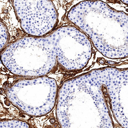 DPEP1 Recombinant Rabbit mAb (S-R293)