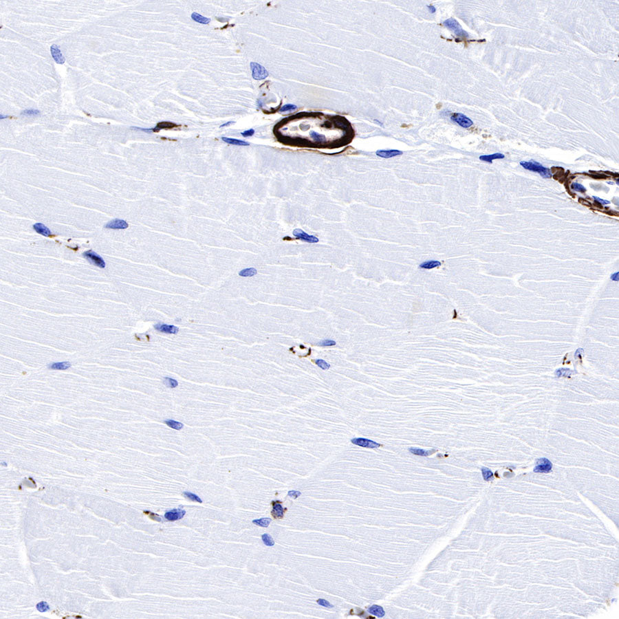 alpha smooth muscle Actin (SMA) Recombinant Rabbit mAb,PBS Only (SDT-132-63)