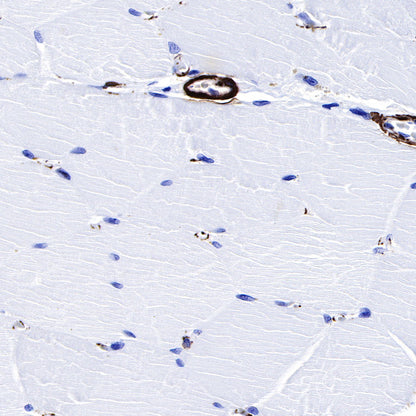 alpha smooth muscle Actin (SMA) Recombinant Rabbit mAb,PBS Only (SDT-132-63)