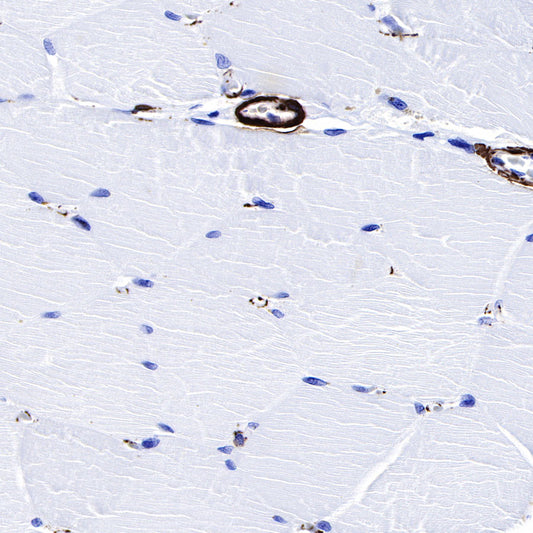alpha smooth muscle Actin (SMA) Recombinant Rabbit mAb,PBS Only (SDT-132-63)