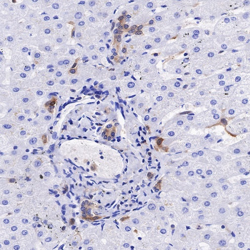 IL-18 Recombinant Rabbit mAb (S-2142-2)