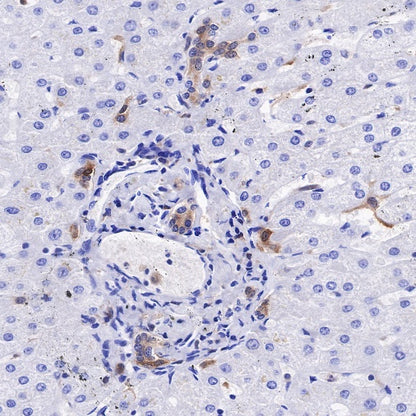 IL-18 Recombinant Rabbit mAb (S-2142-2)