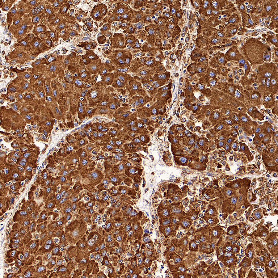 P4HB Recombinant Rabbit mAb