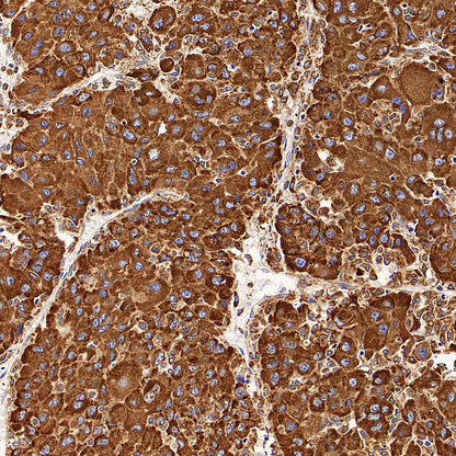 P4HB Recombinant Rabbit mAb