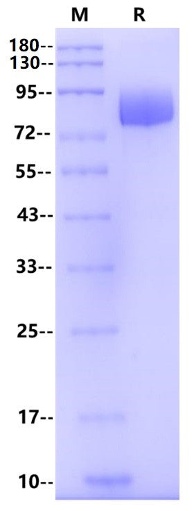 Siglec-6/CD327 Fc Chimera Protein, Human
