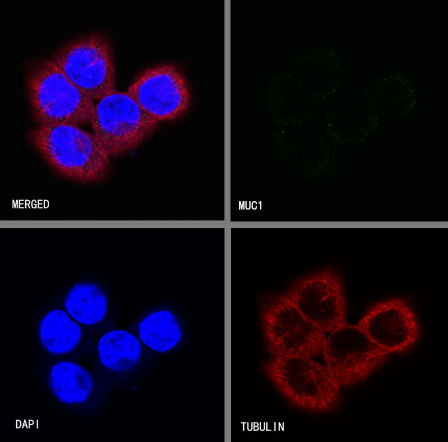 S-RMab® MUC1/EMA Recombinant Rabbit mAb (SDT-776-49)