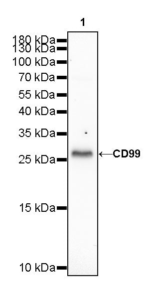CD99 Recombinant Rabbit mAb (SDT-R122)