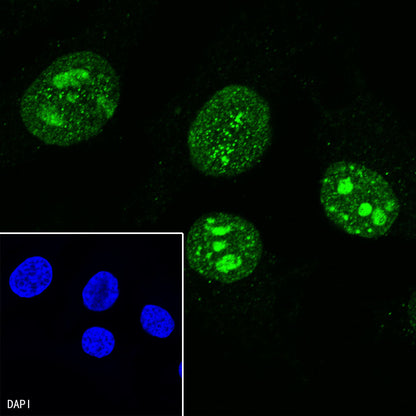 Ki67 Mouse mAb ,PBS Only (SDT-606-33)