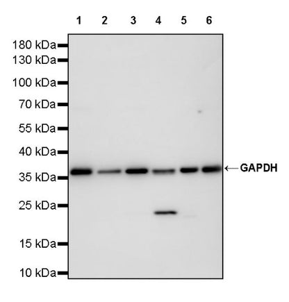 S-RMab® GAPDH Recombinant Rabbit mAb (S-240-147)