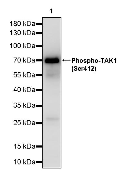 Phospho-TAK1 (Ser412) Recombinant Rabbit mAb (S-3334-138)