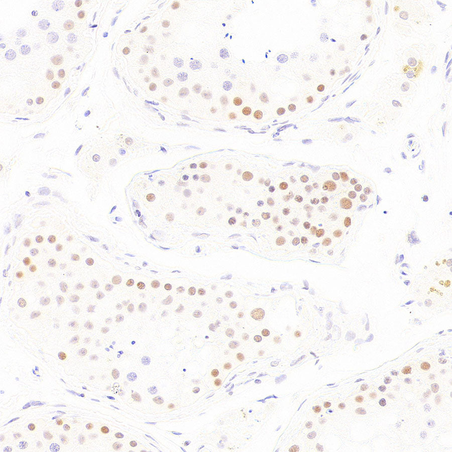 BAP1 Recombinant Rabbit mAb (S-6199)