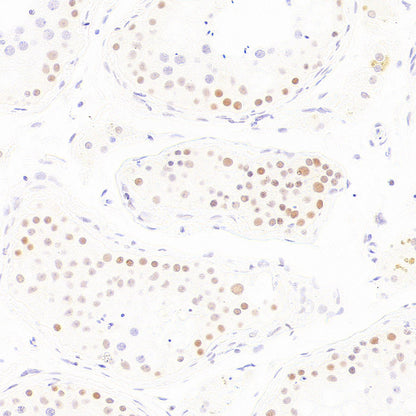 BAP1 Recombinant Rabbit mAb (S-6199)