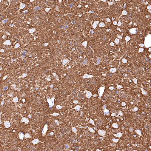 SNAP25 Recombinant Rabbit mAb (S-1828-67)