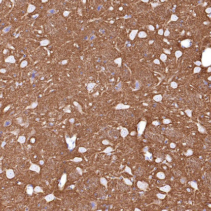 SNAP25 Recombinant Rabbit mAb (S-1828-67)