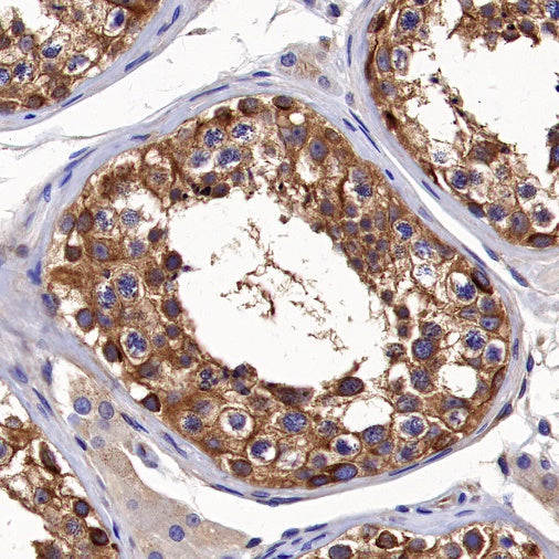α-tubulin Rabbit Polyclonal Antibody