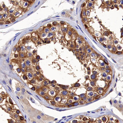 α-tubulin Rabbit Polyclonal Antibody